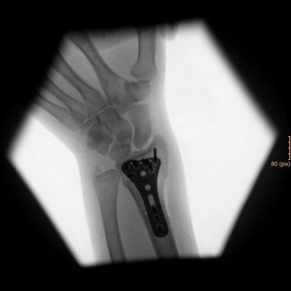 File:2024-08-28 52 8 05 X-ray.jpg