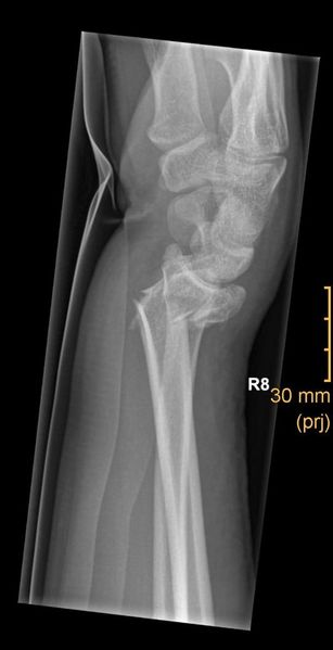 File:2024-08-28 52 8 04 X-ray.jpg