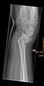 2024-08-28 52 8 04 X-ray.jpg