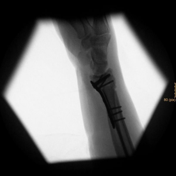 File:2024-08-28 52 8 06 X-ray.jpg